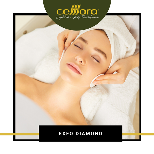Exfo Diamond